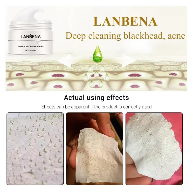 LANBENA White Black Blackhead Remove Mask Shrink Pore Nose Cleansing Stickers Peel Nasal Black Head Strips Face Skin Care